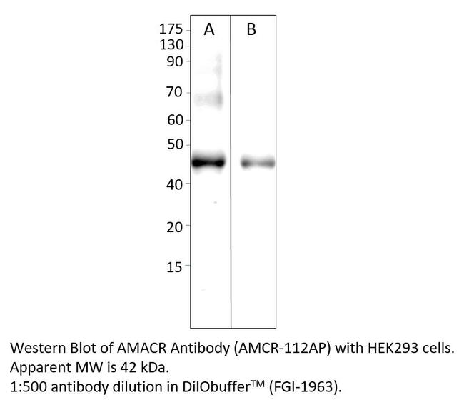 AMACR Antibody in Western Blot (WB)