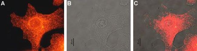 MC1 Receptor Antibody in Immunocytochemistry (ICC/IF)