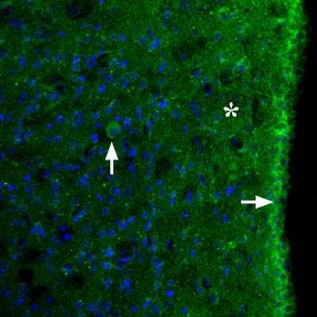 MC3 Receptor (extracellular) Antibody in Immunohistochemistry (Frozen) (IHC (F))