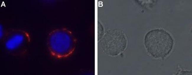 MC4 Receptor (extracellular) Antibody in Immunocytochemistry (ICC/IF)