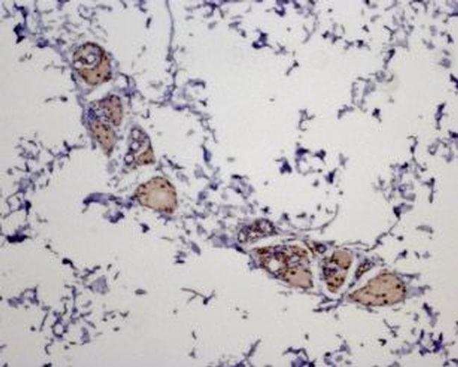 MC5 Receptor Antibody in Immunohistochemistry (Paraffin) (IHC (P))