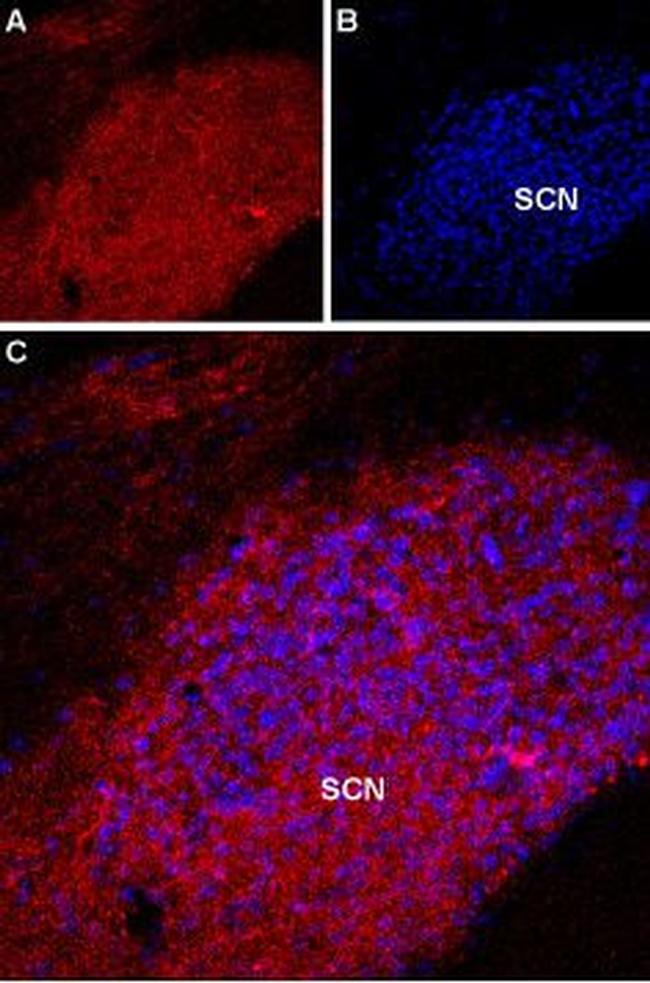 Melatonin Receptor 1A (MTNR1A) Antibody in Immunohistochemistry (IHC)