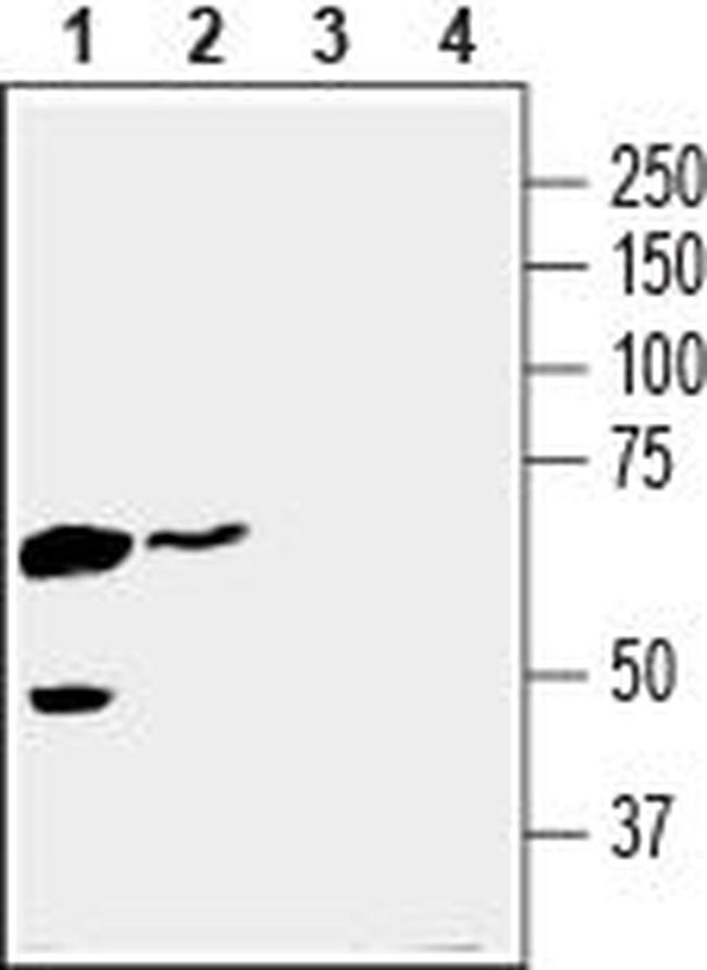 MCT4 (SLC16A3) Antibody in Western Blot (WB)