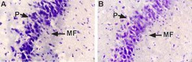 NGF Antibody in Immunohistochemistry (IHC)