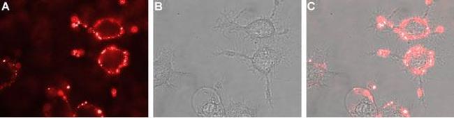 Nicotinic Acetylcholine Receptor alpha 6 (CHRNA6) (extracellular) Antibody in Immunocytochemistry (ICC/IF)