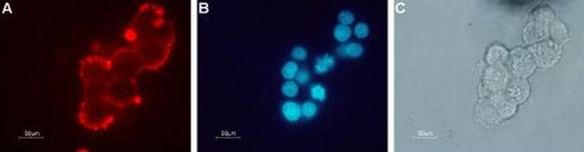 Nicotinic Acetylcholine Receptor beta 2 (CHRNB2) (extracellular) Antibody in Immunocytochemistry (ICC/IF)