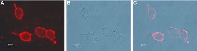 Nicotinic Acetylcholine Receptor beta 2 (CHRNB2) (extracellular) Antibody in Immunocytochemistry (ICC/IF)