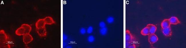 Nicotinic Acetylcholine Receptor beta 4 (CHRNB4) (extracellular) Antibody in Immunocytochemistry (ICC/IF)