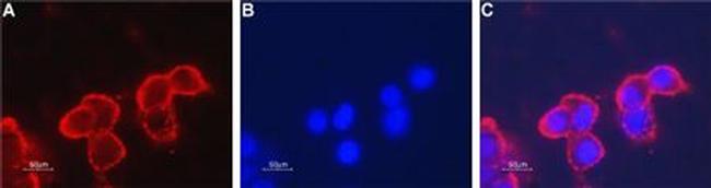 Nicotinic Acetylcholine Receptor beta 4 (CHRNB4) (extracellular) Antibody in Immunocytochemistry (ICC/IF)