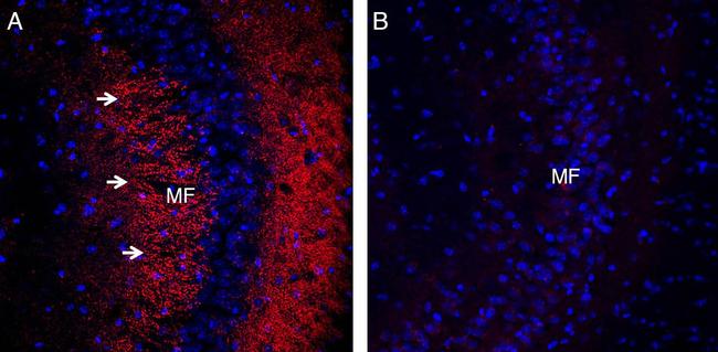 Synaptophysin Antibody in Immunohistochemistry (Frozen) (IHC (F))