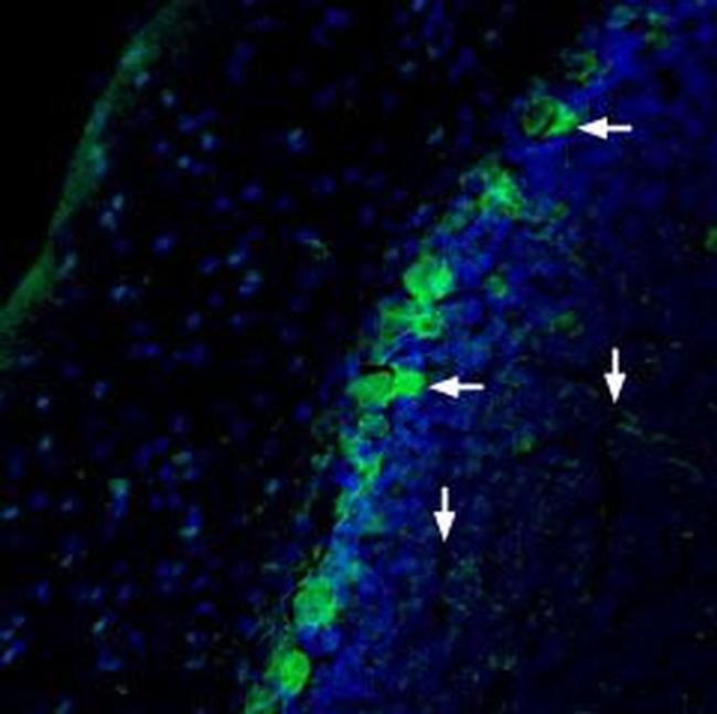 NRG1 (Neuregulin-1) (extracellular) Antibody in Immunohistochemistry (IHC)