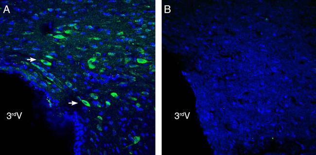 NGL-2/LRRC4 (extracellular) Antibody in Immunohistochemistry (Frozen) (IHC (F))