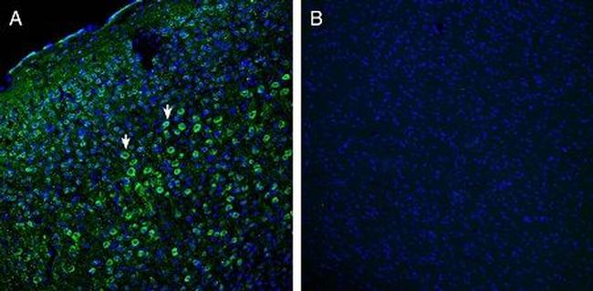 Robo1 (extracellular) Antibody in Immunohistochemistry (Frozen) (IHC (F))