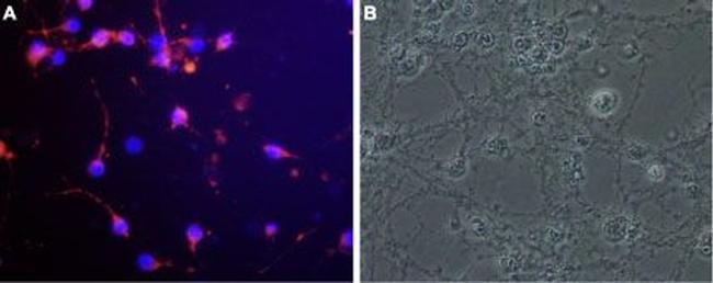 Nogo Receptor (extracellular) Antibody in Immunocytochemistry (ICC/IF)