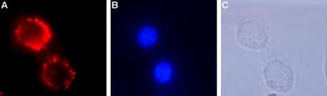 TrkA (extracellular) Antibody in Immunocytochemistry (ICC/IF)