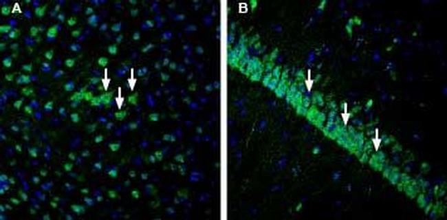 IGF1R (extracellular) Antibody in Immunohistochemistry (Frozen) (IHC (F))