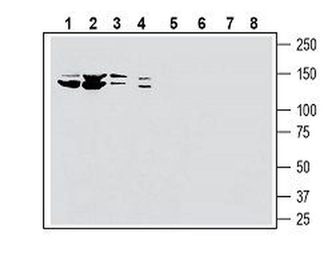 SLC28A3/CNT3 (extracellular) Antibody in Western Blot (WB)