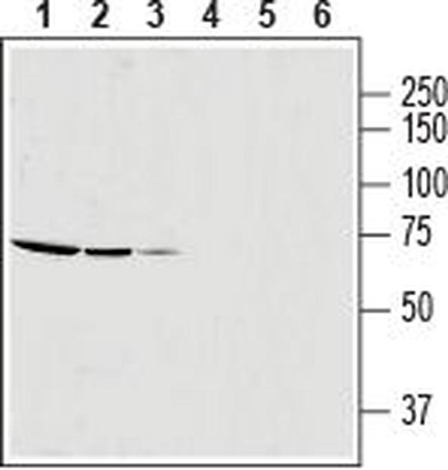 SLC25A12 Antibody in Western Blot (WB)