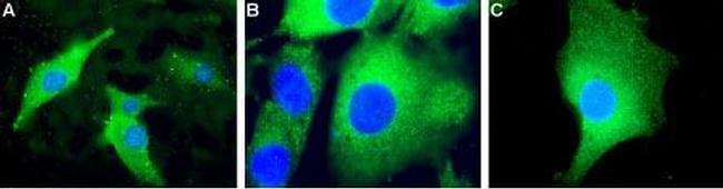 UCP2 Antibody in Immunocytochemistry (ICC/IF)