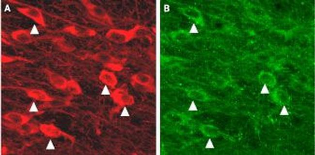 KCNN3 (KCa2.3, SK3) Antibody in Immunohistochemistry (IHC)