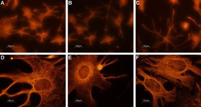 CNGA2 Antibody in Immunocytochemistry (ICC/IF)