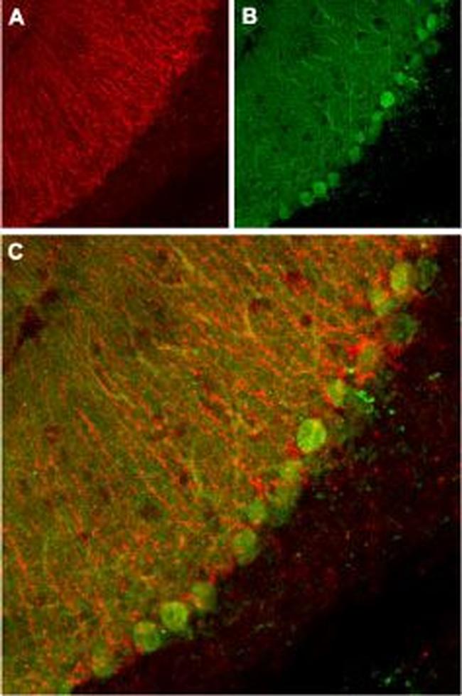 KCNK1 (TWIK-1) (extracellular) Antibody in Immunohistochemistry (IHC)