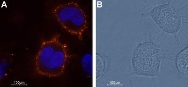 KCNK18 (TRESK) (extracellular) Antibody in Immunocytochemistry (ICC/IF)