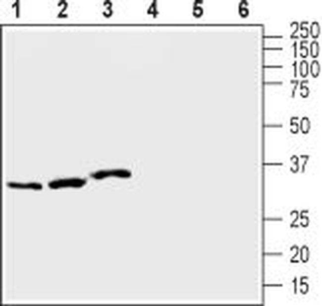 KCNE1 (IsK) Antibody in Western Blot (WB)