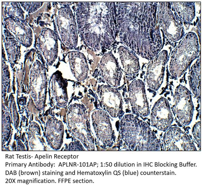 Apelin Receptor Antibody in Immunohistochemistry (IHC)