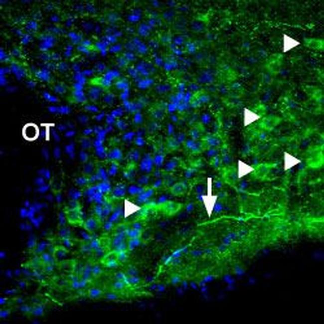 P2X1 Receptor Antibody in Immunohistochemistry (IHC)