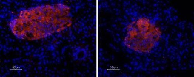 P2X7 Receptor Antibody in Immunohistochemistry (Paraffin) (IHC (P))