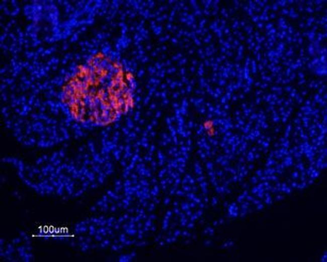 P2X7 Receptor Antibody in Immunohistochemistry (Paraffin) (IHC (P))