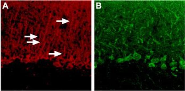 P2Y4 Receptor Antibody in Immunohistochemistry (IHC)