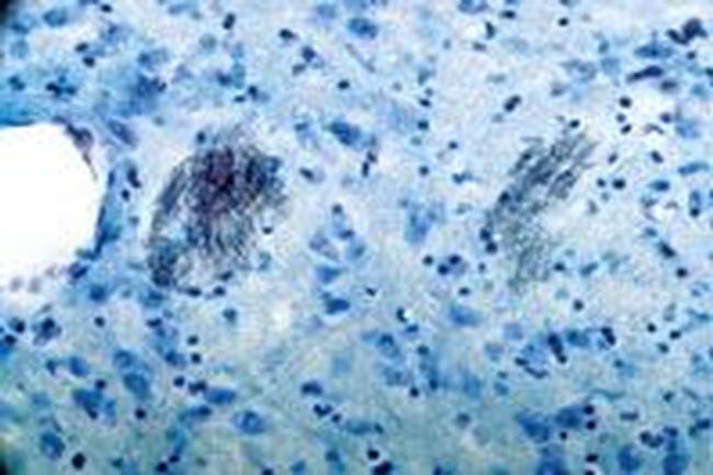 P2Y1 Receptor Antibody in Immunohistochemistry (IHC)