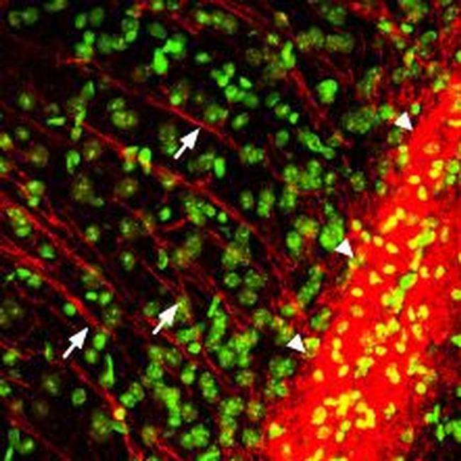 P2Y12 Receptor Antibody in Immunohistochemistry (IHC)