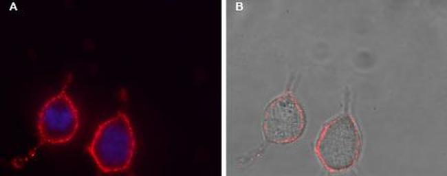 P2Y12 Receptor (extracellular) Antibody in Immunocytochemistry (ICC/IF)