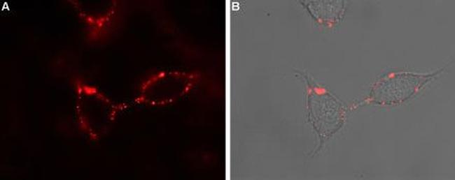 P2Y1 Receptor (extracellular) Antibody in Immunocytochemistry (ICC/IF)