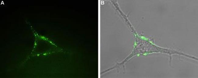 P2Y1 Receptor (extracellular) Antibody in Immunocytochemistry (ICC/IF)