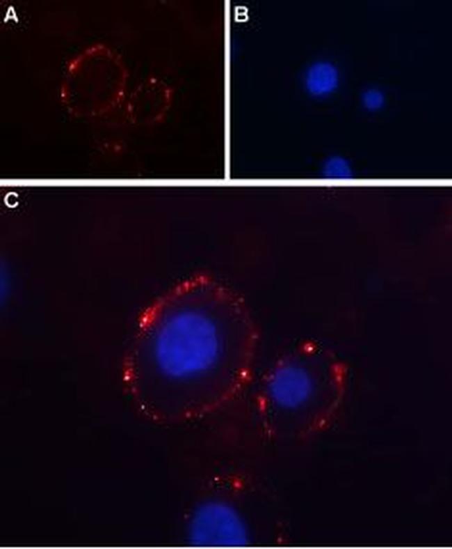 P2X3 Receptor (extracellular) Antibody in Immunocytochemistry (ICC/IF)