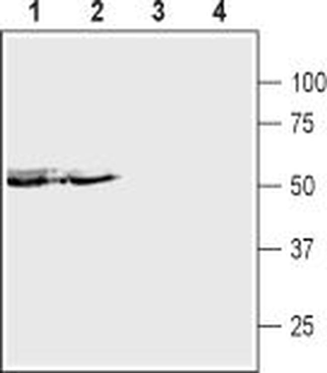 P2X5 Receptor (extracellular) Antibody in Western Blot (WB)