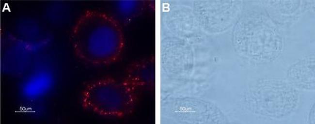 PAR1 (F2R) (extracellular) Antibody in Immunocytochemistry (ICC/IF)