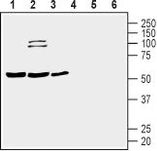 Prostacyclin Receptor (PTGIR) (extracellular) Antibody in Western Blot (WB)