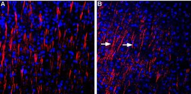 Shank3 Antibody in Immunohistochemistry (Frozen) (IHC (F))