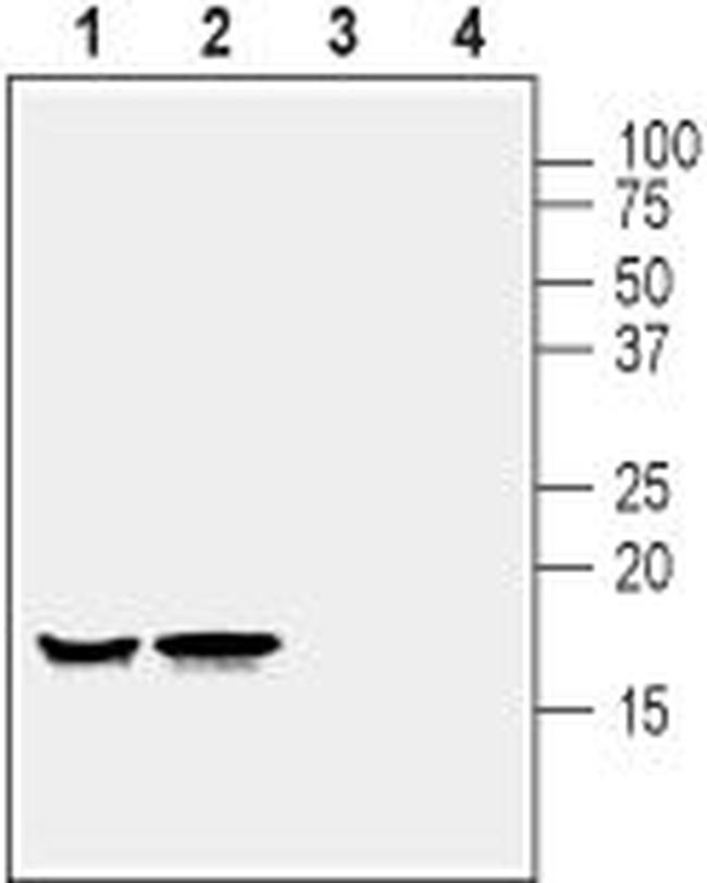 Alpha-Synuclein Antibody in Western Blot (WB)