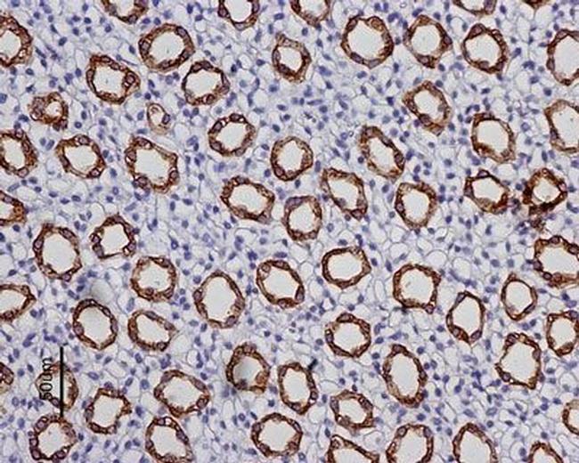 Aquaporin 2 Antibody in Immunohistochemistry (Paraffin) (IHC (P))