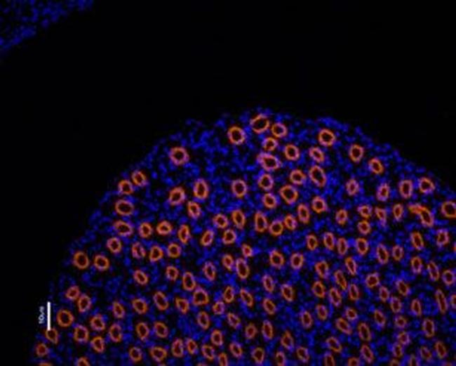 Aquaporin 2 Antibody in Immunohistochemistry (Paraffin) (IHC (P))