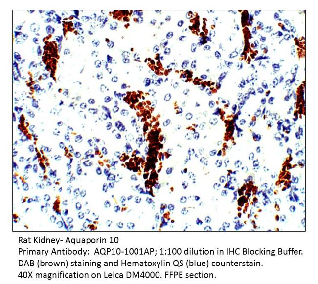 Aquaporin 10 Antibody in Immunohistochemistry (IHC)