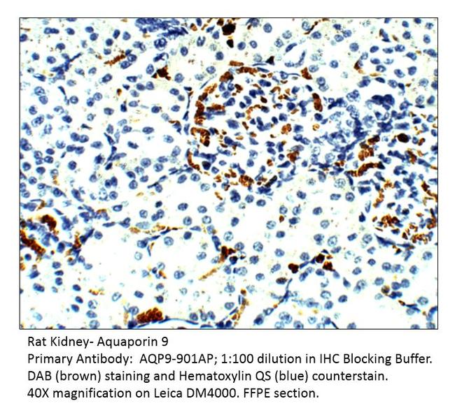 Aquaporin 9 Antibody in Immunohistochemistry (IHC)