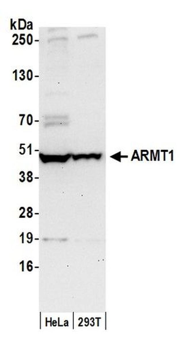 ARMT1 Antibody in Western Blot (WB)