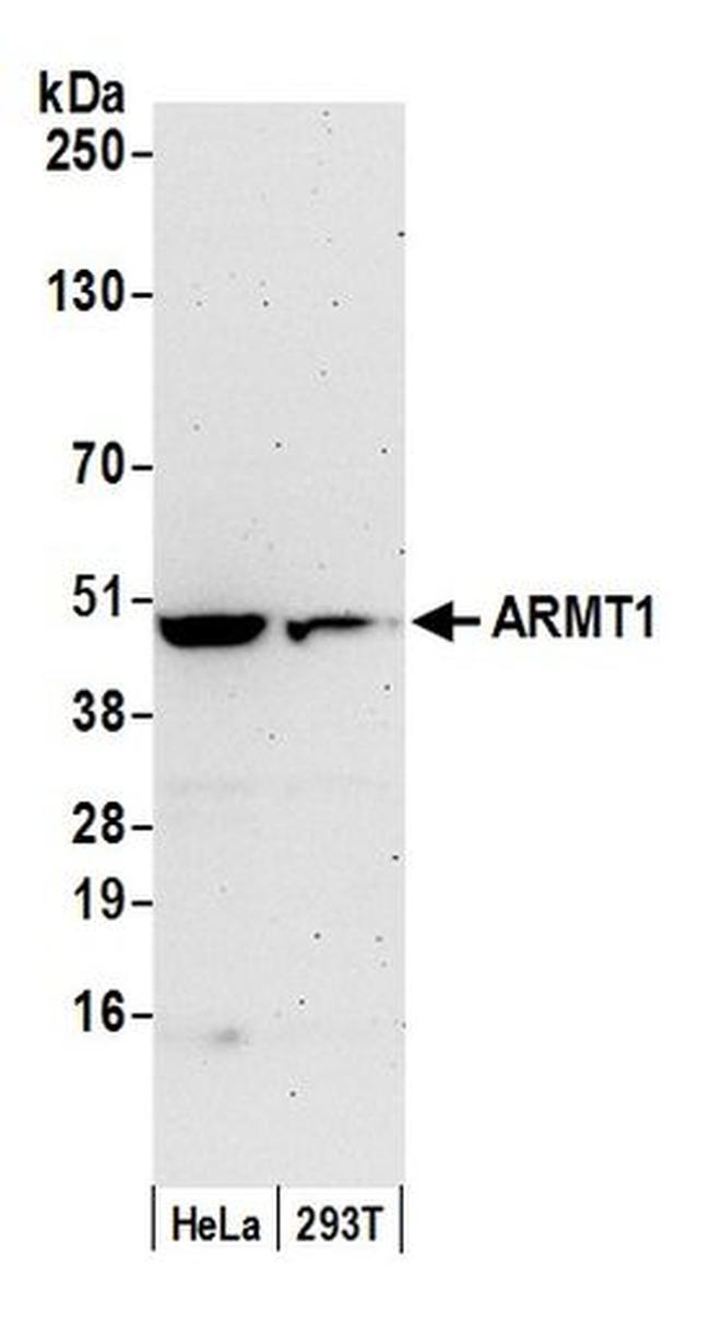 ARMT1 Antibody in Western Blot (WB)